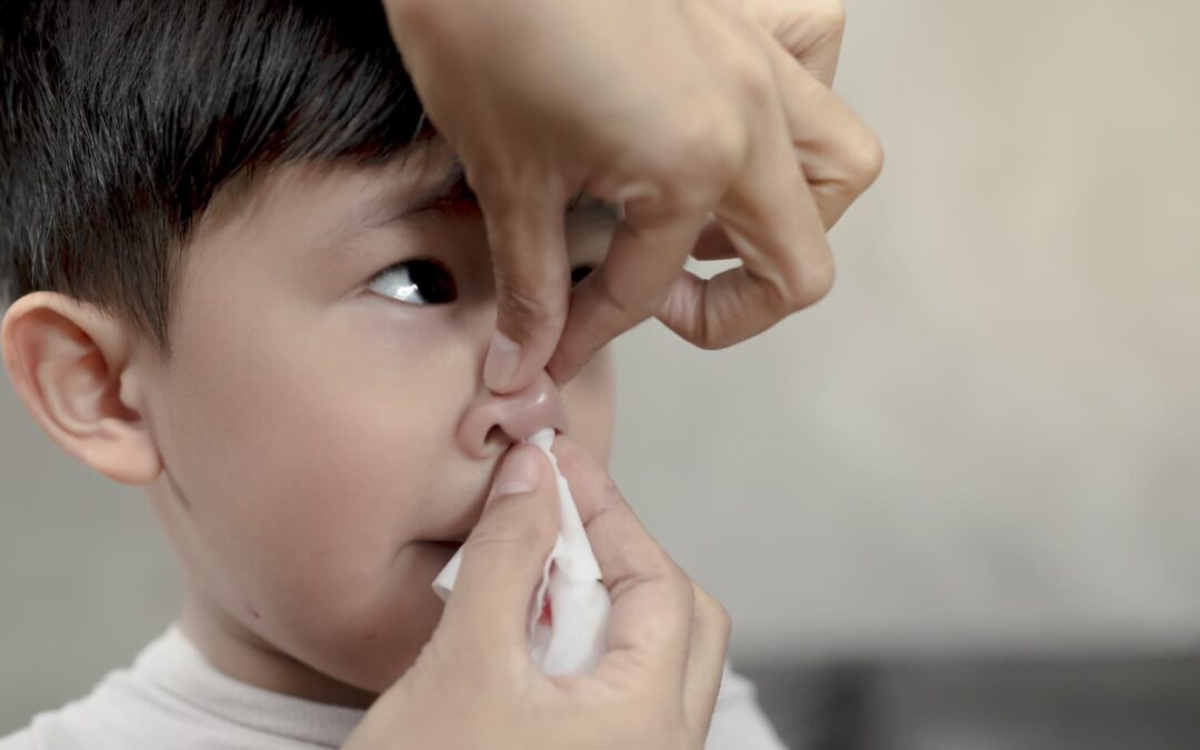 When to worry about nosebleeds